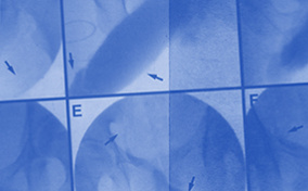 Medical imaging of a venous leak occurring.